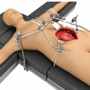 Set Thompson Retractor